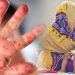 বাংলাদেশে শিশুদের ”হাম” রোগ মহামারি আকারে ছড়াচেছ ৯৪ শিশুর মৃত্যু ১৯ দিনে, টাস্ক ফোর্স গঠনের দাবি ওয়ার্কার্স পার্টির