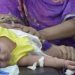 বাংলাদেশে হামে শিশুমৃত্যু :প্রশাসনের ভূমিকা নিয়ে প্রশ্ন তুলেছেন জনস্বাস্থ্য বিশেষজ্ঞ ও চিকিৎসকরা