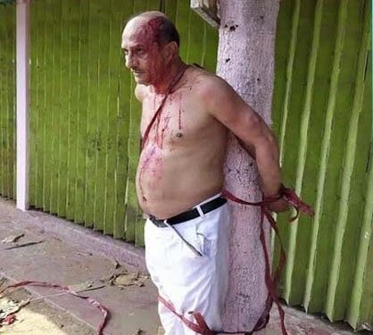 Minority leader tied to a tree and tortured in Bangladesh