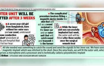 7-year-old Bangladeshi girl born without ears gets implant at city hospital India